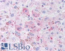 DIABLO / SMAC Antibody - Anti-DIABLO / SMAC antibody IHC of human liver. Immunohistochemistry of formalin-fixed, paraffin-embedded tissue after heat-induced antigen retrieval. Antibody dilution 1:500.