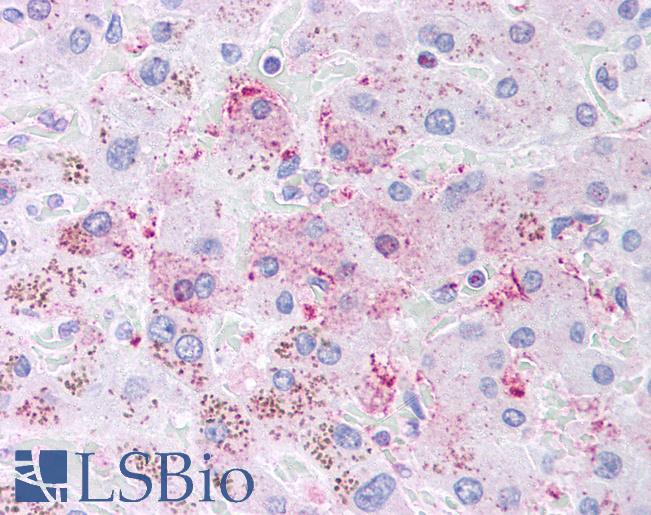 DIABLO / SMAC Antibody - Anti-DIABLO / SMAC antibody IHC of human liver. Immunohistochemistry of formalin-fixed, paraffin-embedded tissue after heat-induced antigen retrieval. Antibody dilution 1:500.