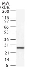 DIABLO / SMAC Antibody - Western blot of Smac/DIABLO in HeLa cell lysate.