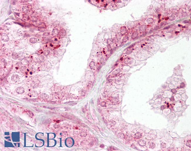 DIABLO / SMAC Antibody - Anti-DIABLO / SMAC antibody IHC of human prostate. Immunohistochemistry of formalin-fixed, paraffin-embedded tissue after heat-induced antigen retrieval. Antibody concentration 10 ug/ml.