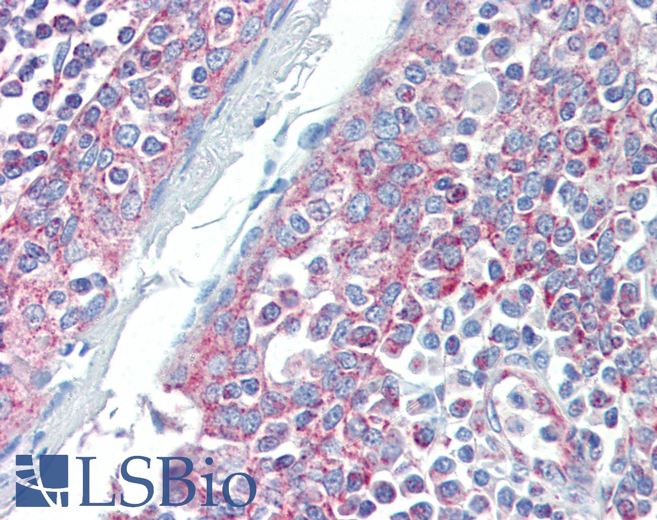 DIABLO / SMAC Antibody - Anti-DIABLO / SMAC antibody IHC of human tonsil. Immunohistochemistry of formalin-fixed, paraffin-embedded tissue after heat-induced antigen retrieval. Antibody concentration 10 ug/ml.