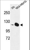 DIAPH2 Antibody - Western blot of DIAPH2 Antibody in 293, MDA-MB435 cell line lysates (35 ug/lane). DIAPH2 (arrow) was detected using the purified antibody.