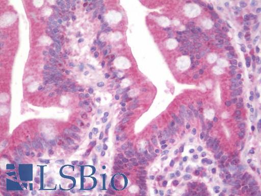 DIMT1L Antibody - Anti-DIMT1L antibody IHC staining of human small intestine. Immunohistochemistry of formalin-fixed, paraffin-embedded tissue after heat-induced antigen retrieval. Antibody dilution 1:100.