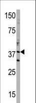 DIMT1L Antibody - Western blot of anti-DIMT1 antibody in T47D cell line lysate (35 ug/lane). DIMT1(arrow) was detected using the purified antibody.