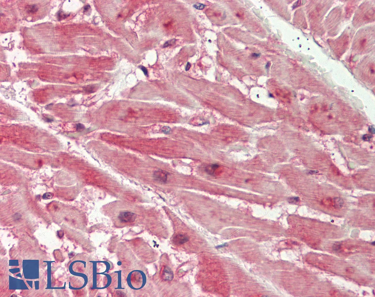 Dipeptidylpeptidase 8 / DPP8 Antibody - Human Heart: Formalin-Fixed, Paraffin-Embedded (FFPE)
