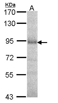 Dipeptidylpeptidase 8 / DPP8 Antibody - Sample (30 ug of whole cell lysate). A: A549. 7.5% SDS PAGE. Dipeptidylpeptidase 8 / DPP8 antibody diluted at 1:1000.