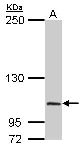 Dipeptidylpeptidase 8 / DPP8 Antibody - Sample (50 ug of whole cell lysate). A: Mouse brain. 5% SDS PAGE. Dipeptidylpeptidase 8 / DPP8 antibody diluted at 1:2000.