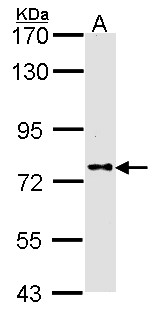 Dipeptidylpeptidase 8 / DPP8 Antibody - Sample (30 ug of whole cell lysate). A: A431. 7.5% SDS PAGE. DPP8 antibody. DPP8 antibody diluted at 1:1000. 