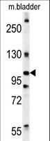 DIS3 Antibody - DIS3 Antibody western blot of mouse bladder tissue lysates (15 ug/lane). The DIS3 antibody detected DIS3 protein (arrow).