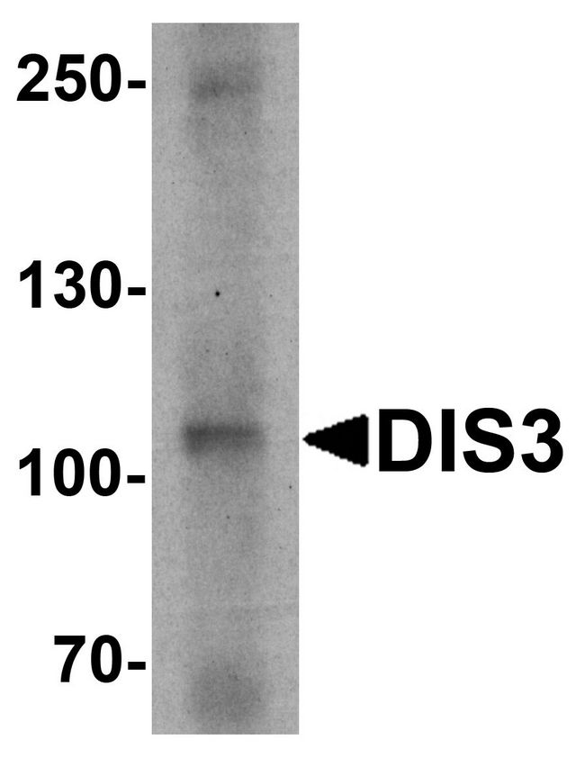 DIS3 Antibody - Western blot analysis of DIS3 in human ovary tissue lysate with DIS3 antibody at 1 ug/ml.