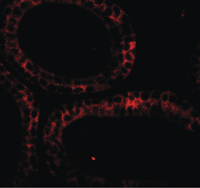 DIS3 Antibody - Immunofluorescence of DIS3 in mouse testis tissue with DIS3 antibody at 20 ug/ml.