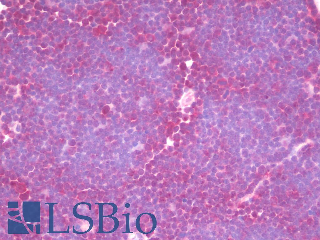 DIS3 Antibody - Anti-DIS3 antibody IHC staining of human thymus. Immunohistochemistry of formalin-fixed, paraffin-embedded tissue after heat-induced antigen retrieval. Antibody concentration 10 ug/ml.
