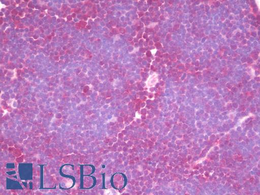 DIS3 Antibody - Anti-DIS3 antibody IHC staining of human thymus. Immunohistochemistry of formalin-fixed, paraffin-embedded tissue after heat-induced antigen retrieval. Antibody concentration 10 ug/ml.