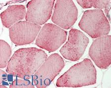 DIS3L2 Antibody - Human Skeletal Muscle: Formalin-Fixed, Paraffin-Embedded (FFPE)