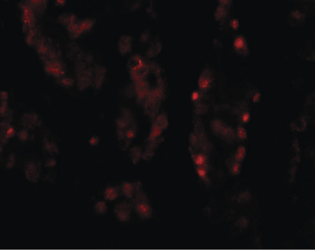 DISPA / DISP1 Antibody - Immunofluorescence of DISP1 in human kidney tissue with DISP1 antibody at 20 ug/ml.
