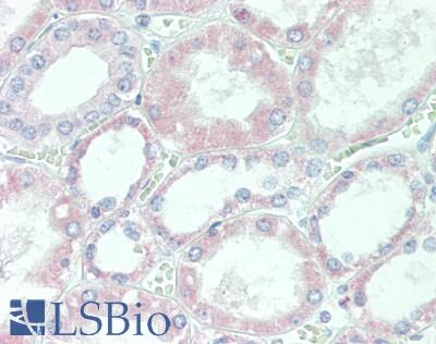 DIXDC1 Antibody - Human Kidney: Formalin-Fixed, Paraffin-Embedded (FFPE), at a concentration of 5 ug/ml. 