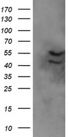 DIXDC1 Antibody - HEK293T cells were transfected with the pCMV6-ENTRY control (Left lane) or pCMV6-ENTRY DIXDC1 (Right lane) cDNA for 48 hrs and lysed. Equivalent amounts of cell lysates (5 ug per lane) were separated by SDS-PAGE and immunoblotted with anti-DIXDC1.