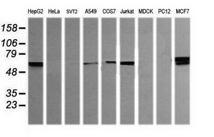 DIXDC1 Antibody - Western blot of extracts (35 ug) from 9 different cell lines by using g anti-DIXDC1 monoclonal antibody (HepG2: human; HeLa: human; SVT2: mouse; A549: human; COS7: monkey; Jurkat: human; MDCK: canine; PC12: rat; MCF7: human).