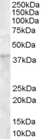 DKK1 Antibody - DKK1 antibody (1µg/ml) staining of Human Bone Marrow lysate (35µg protein in RIPA buffer). Detected by chemiluminescence.