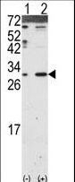 DKK2 Antibody - Western blot of DKK2 (arrow) using DKK2 Antibody. 293 cell lysates (2 ug/lane) either nontransfected (Lane 1) or transiently transfected with the DKK2 gene (Lane 2) (Origene Technologies).