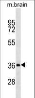 DKK2 Antibody - DKK2 Antibody (T46) western blot of mouse brain tissue lysates (35 ug/lane). The DKK2 antibody detected the DKK2 protein (arrow).