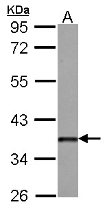 DKK3 Antibody - Sample (30 ug of whole cell lysate) A: 293T 10% SDS PAGE DKK3 antibody diluted at 1:1000