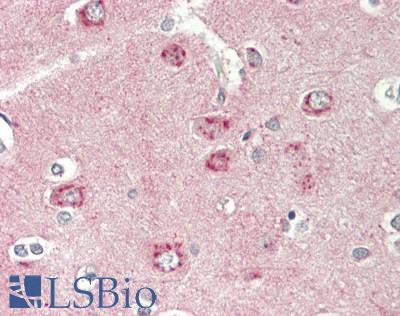 DKK3 Antibody - Human Brain, Cortex: Formalin-Fixed, Paraffin-Embedded (FFPE)