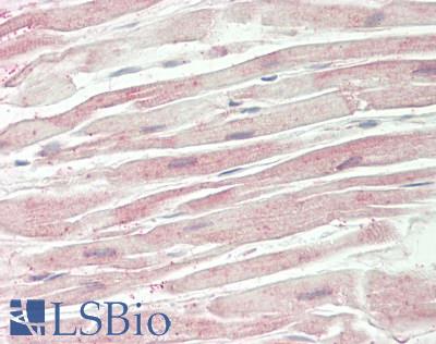 DKK3 Antibody - Human Heart: Formalin-Fixed, Paraffin-Embedded (FFPE)