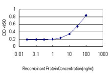 DLD / Diaphorase / E3 Antibody - Detection limit for recombinant GST tagged DLD is approximately 1 ng/ml as a capture antibody.