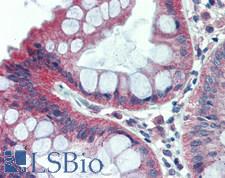 DLG1 / SAP97 Antibody - Human Colon: Formalin-Fixed, Paraffin-Embedded (FFPE)