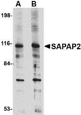 DLGAP2 Antibody - Western blot of DLGAP2 in L1210 cell lysate with DLGAP2 antibody at (A) 0.5 and (B) 1 ug/ml.