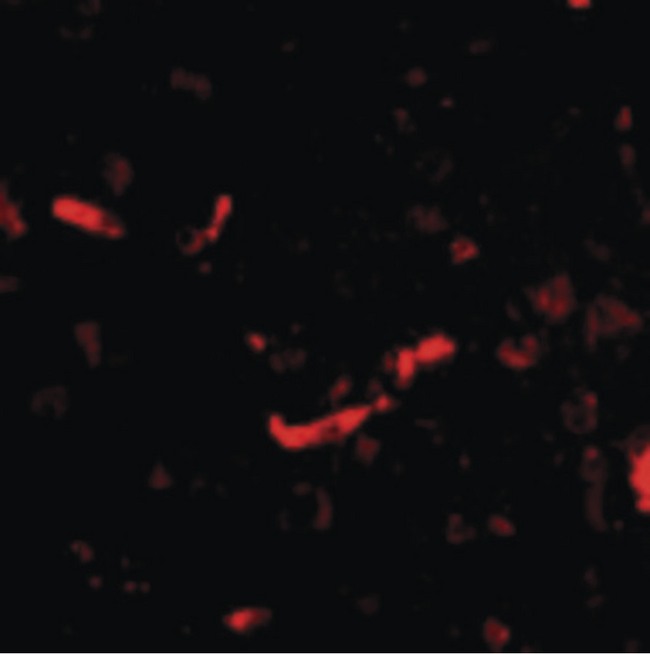 DLGAP2 Antibody - Immunofluorescence of SAPAP2 in Human Brain cells with SAPAP2 antibody at 20 ug/ml.