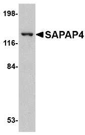 DLGAP4 Antibody - Western blot of DLGAP4 in SK-N-SH cell lysate with DLGAP4 antibody at 1 ug/ml.