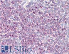 DLL1 Antibody - Anti-DLL1 antibody IHC of human spleen. Immunohistochemistry of formalin-fixed, paraffin-embedded tissue after heat-induced antigen retrieval. Antibody dilution 5-10 ug/ml.
