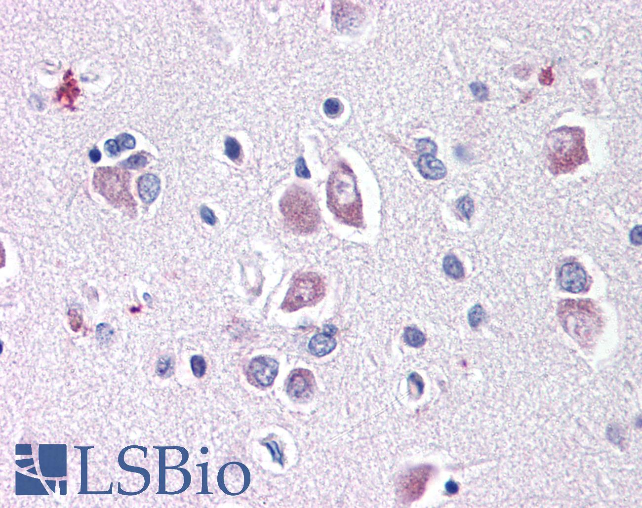 DLL1 Antibody - Anti-DLL1 antibody IHC of human brain. Immunohistochemistry of formalin-fixed, paraffin-embedded tissue after heat-induced antigen retrieval. Antibody concentration 10 ug/ml.