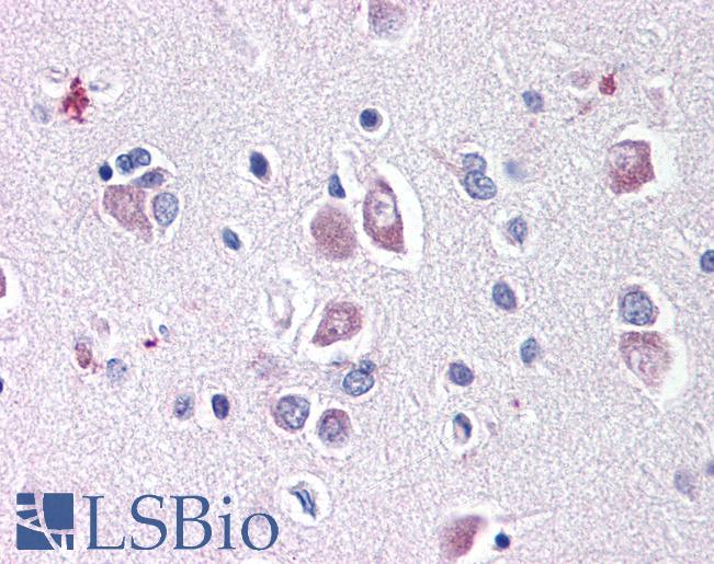 DLL1 Antibody - Anti-DLL1 antibody IHC of human brain. Immunohistochemistry of formalin-fixed, paraffin-embedded tissue after heat-induced antigen retrieval. Antibody concentration 10 ug/ml.