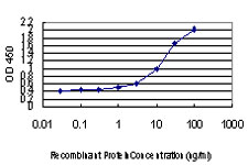 DLX2 Antibody - Detection limit for recombinant GST tagged DLX2 is approximately 1 ng/ml as a capture antibody.