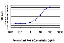 DLX2 Antibody - Detection limit for recombinant GST tagged DLX2 is approximately 1 ng/ml as a capture antibody.
