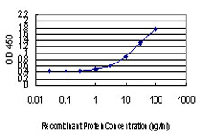 DLX2 Antibody - Detection limit for recombinant GST tagged DLX2 is approximately 0.3 ng/ml as a capture antibody.