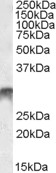 DLX5 Antibody - DLX5 antibody (1 ug/ml) staining of Human Bone Marrow lysate (35 ug protein/ml in RIPA buffer). Primary incubation was 1 hour. Detected by chemiluminescence.