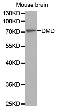 DMD / Dystrophin Antibody - Western blot analysis of extracts of mouse brain tissue cells lines, using DMD antibody.