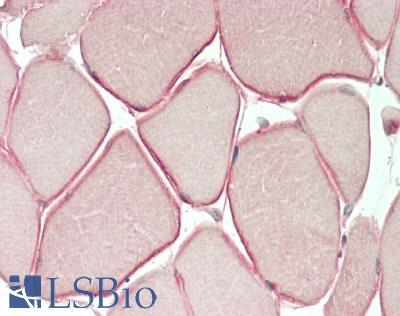 DMD / Dystrophin Antibody - Human Skeletal Muscle: Formalin-Fixed, Paraffin-Embedded (FFPE)