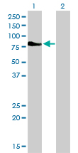DMPK / DM Antibody - Western Blot analysis of DMPK expression in transfected 293T cell line by DMPK monoclonal antibody (M01), clone 2F7.Lane 1: DMPK transfected lysate(69.4 KDa).Lane 2: Non-transfected lysate.