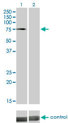 DMPK / DM Antibody - Western blot analysis of DMPK over-expressed 293 cell line, cotransfected with DMPK Validated Chimera RNAi (Lane 2) or non-transfected control (Lane 1). Blot probed with DMPK monoclonal antibody (M01) clone 2F7 . GAPDH ( 36.1 kDa ) used as specificity and loading control.