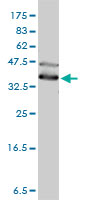 DNAJA4 Antibody - DNAJA4 monoclonal antibody (M01), clone 4B4-1F2 Western blot of DNAJA4 expression in HeLa.