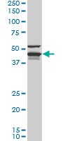 DNAJA4 Antibody - DNAJA4 monoclonal antibody (M01), clone 4B4-1F2. Western blot of DNAJA4 expression in Jurkat.