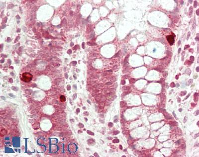 DNAJA4 Antibody - Human Small Intestine: Formalin-Fixed, Paraffin-Embedded (FFPE)