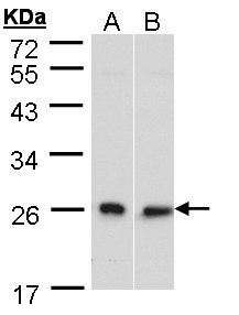 DNAJB6 Antibody - Sample (30 ug of whole cell lysate). A: HeLa S3, B: Molt-4 . 10% SDS PAGE. DNAJB6 / DnaJ antibody diluted at 1:500