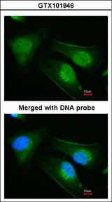 DNAJB6 Antibody - Immunofluorescence of paraformaldehyde-fixed HeLa using DNAJB6 antibody at 1:200 dilution.