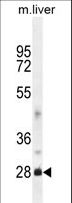 DNAJB8 Antibody - DNAJB8 Antibody western blot of mouse liver tissue lysates (35 ug/lane). The DNAJB8 antibody detected the DNAJB8 protein (arrow).
